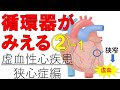 【狭心症】虚血性心疾患①　狭心症の種類と治療薬　医療系学生必見！