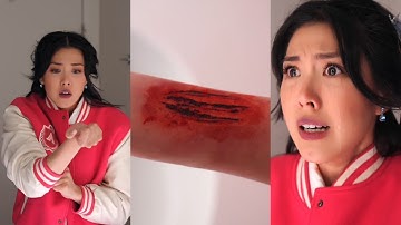 Alan Chikin Chow - A zombie bit me