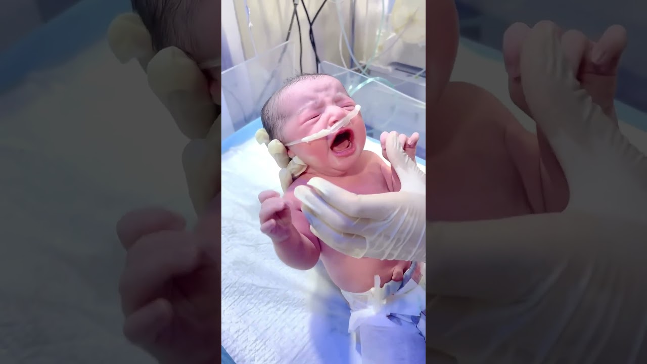 World Welcomes a Cute Baby | First Moments After Birth 