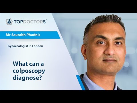 What can a colposcopy diagnose? - Online interview