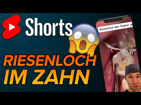 Video: Eckzahn-Aszites