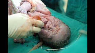 Famous Signs That A Baby May Have Suffered A Brain Injury At Birth Net Worth