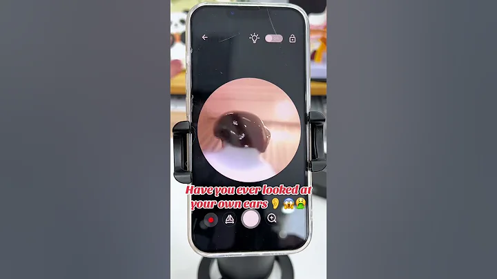 Try This Game-Changing Ear Wax Removal Tool with Camera #earwax