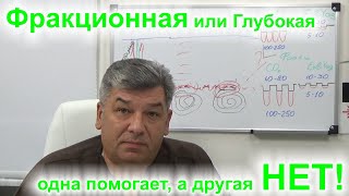 Почему фракционная лазерная шлифовка не справляется с рубцами постакне.#8