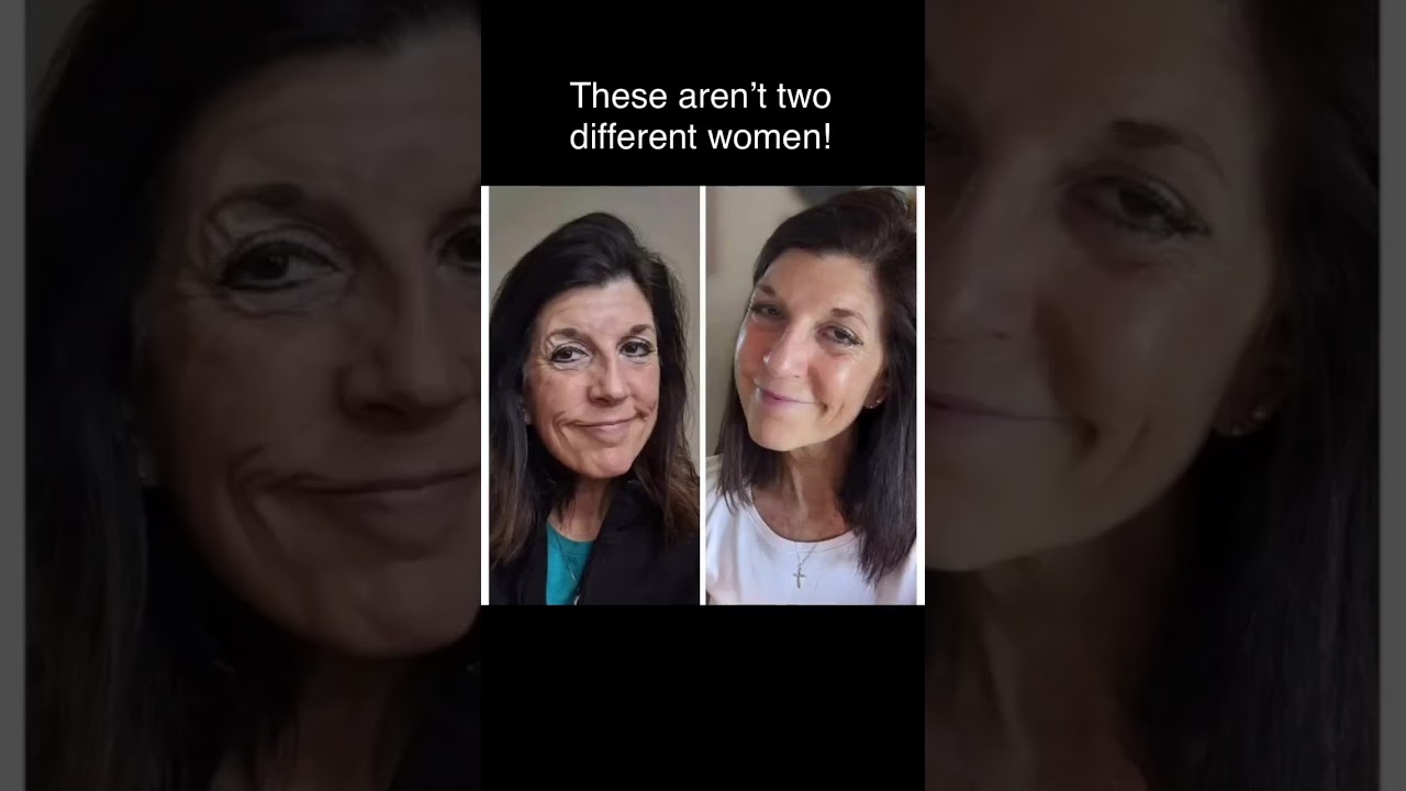 Shocking pictures! Liquid collagen activation is off the chain effective!