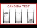 Do You Have Candida? Take The "Spit Test"!