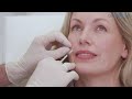 Naturallooking antiageing  latest dermal fillers with doctorssurgeons in london  bristol