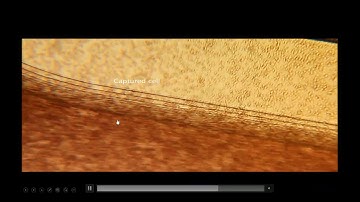 Multiplexed Analysis for Complete Liquid Biopsy Solutions