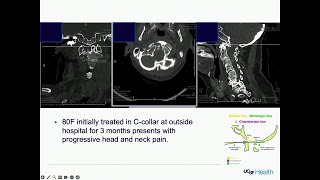Spine Trauma and Deformity Intraoperative Imaging/Assessment - Patrick Maloney, MD