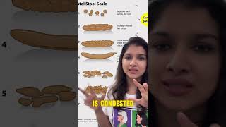 Poop Talk: Bristol Stool Chart Explained (Types 3-5)! #health  #wellness  #guthealth  #shorts