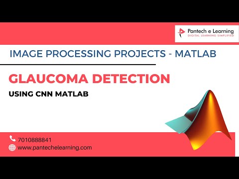Glaucoma Detection using CNN Matlab