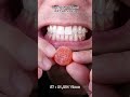 The Most Satisfying Chocolate and Candy ASMR Compilation 🍫🍬 #DoctorTristanPeh #Chocolate #Candy