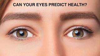 BEYOND DARK CIRCLES: The TCM Secrets Hidden Around the Eyes