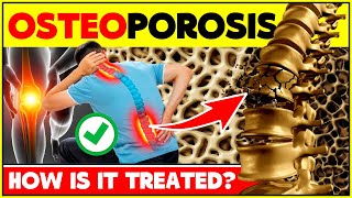 How To Treat Osteoporosis And How Not To Make It Worse? | Osteoporosis Treatment And Cure