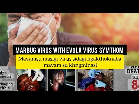 Marbug virus tagi ngakthoknaba mayam khngminahou-si karmba mayongda formd twrkpage haibasu khnghwsi