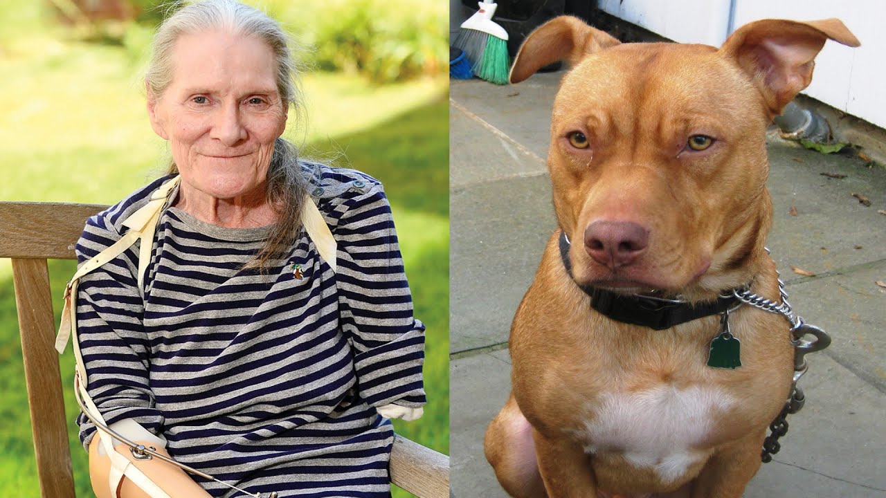 Woman lost an arm after her own Pit Bull attacked her - YouTube