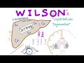 Wilson disease hepatolenticular degeneration copper overload