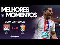 O ENDRICK É UMA ABERRAÇÃO Lyon 2x0 Laval Melhores Momentos Copa Da França
