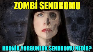 ZOMBİ SENDROMU- KRONİK YORGUNLUK SENDROMU NEDİR VE NASIL KURTULURSUN?