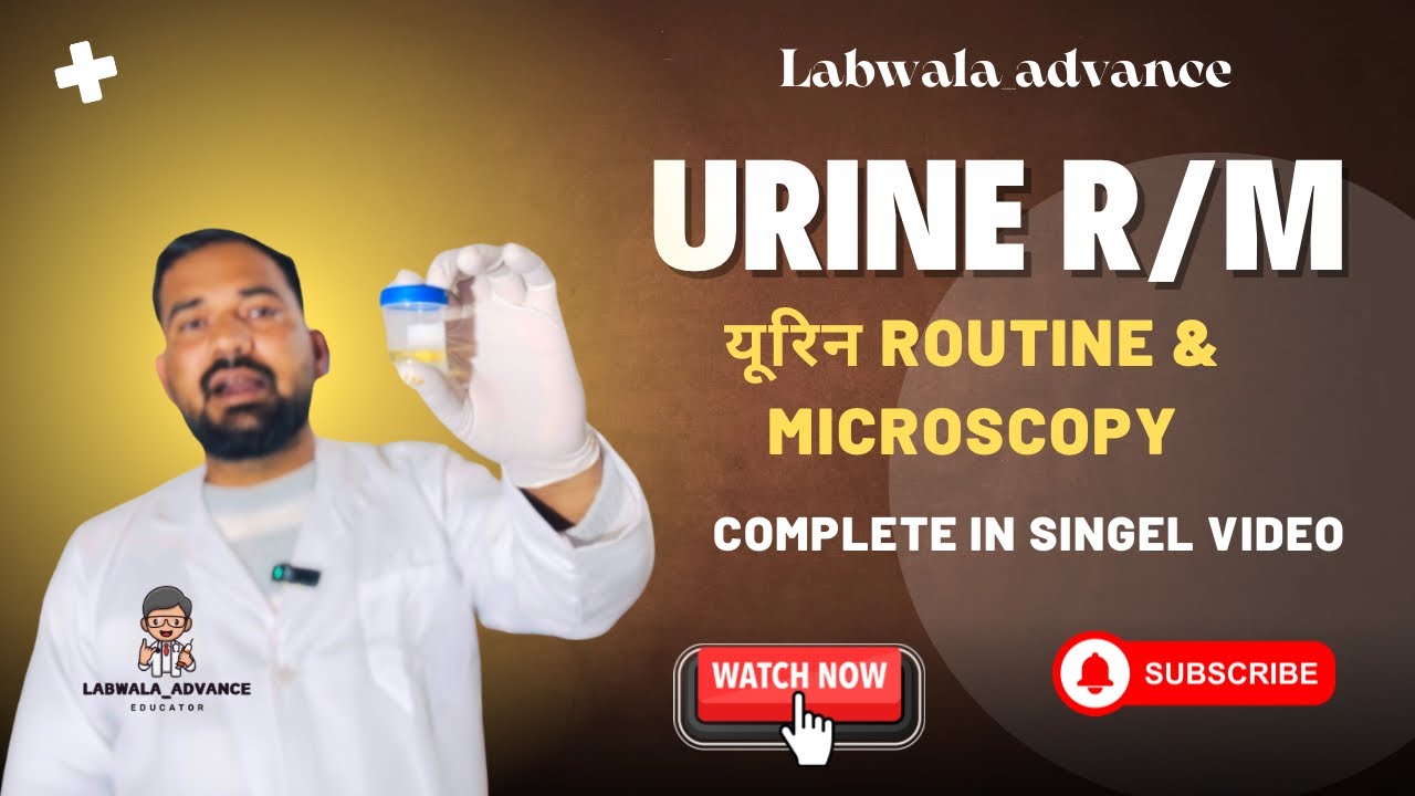 Urine R M Test Urine Test Kaise Hota Hai? | Urine Routine Microscopy (R/M) Report ...