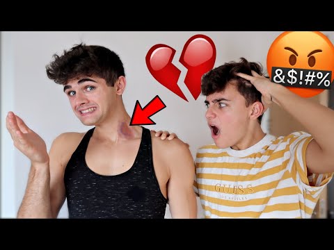 hickey-prank-on-boyfriend-(gay-couple-prank)