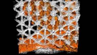 Bone Tissue Engineering