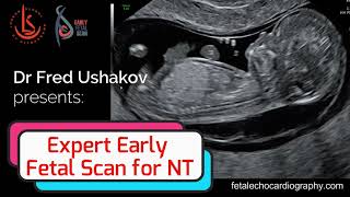 NT Expert: Scanning And Management Of The Fetus With Increased Nuchal Translucency - 2021 NT Expert: Scanning And Management Of The Fetus With Increased Nuchal Translucency - 2021