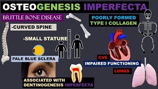 Osteogenesis Imperfecta