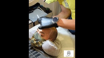 Demonstrating Hairline Design for Hair Tattoo (Scalp Micropigmentation / SMP) | Pixel Pigments