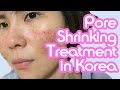 Shrinking my Pores in Korea! (Non-invasive skin treatment)