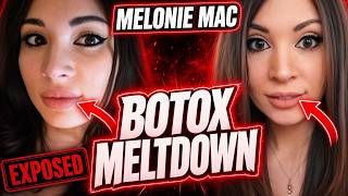 Melonie Mac LIES About Plastic Surgery?!