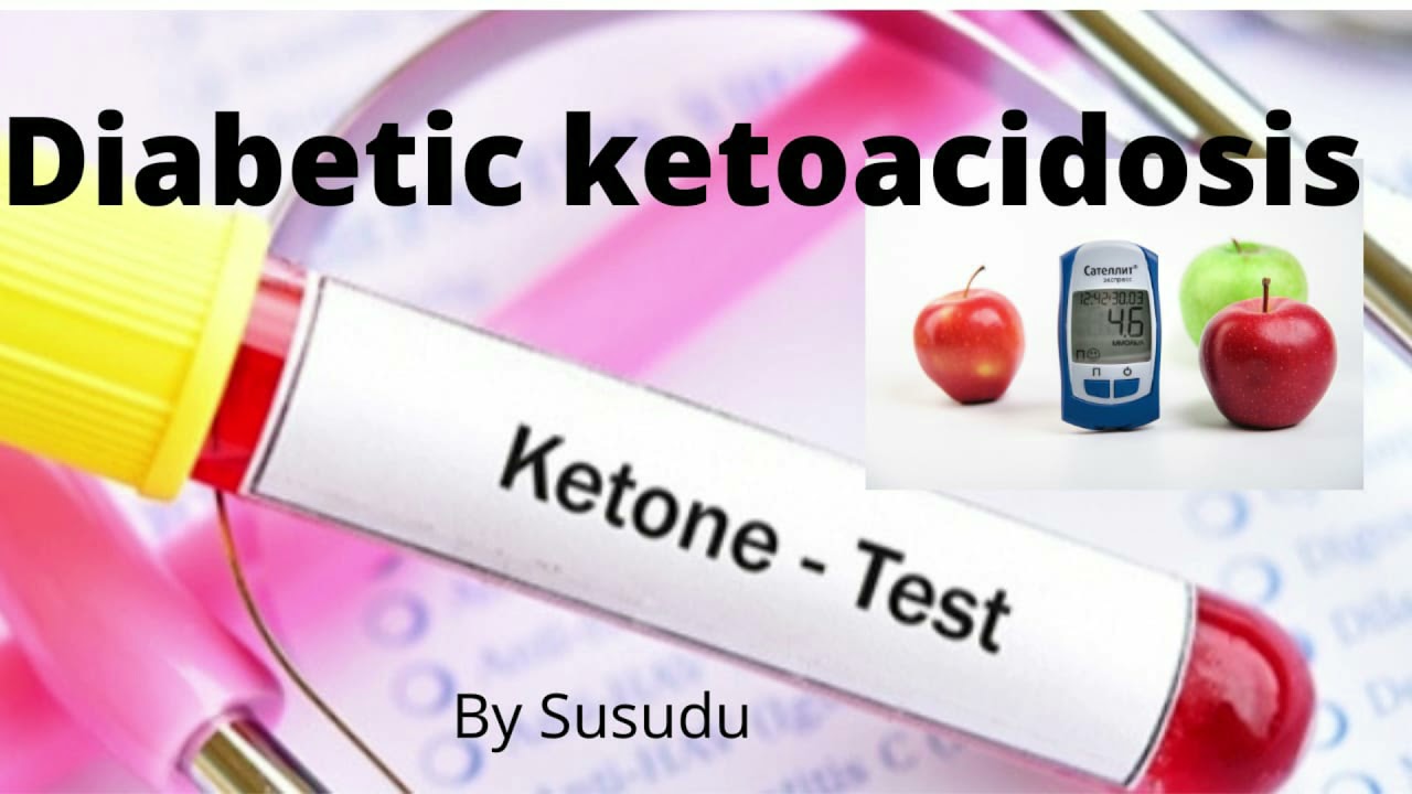 Diabetic ketoacidosis . Susudu sithumini