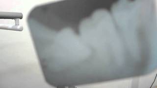 Picture 183.avi