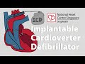 Implantable cardioverterdefibrillator icd