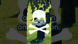 What You Should Know About Osteomyelitis