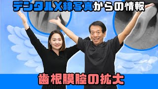 デンタルエックス線写真（レントゲン）から得られる情報について