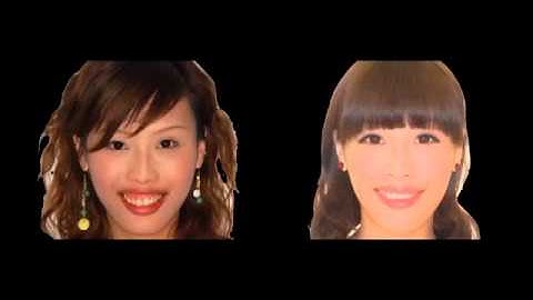 V1  iAOI Case 1 Report by Dr  Yeh Gummy Smile and Multiple missing teeth