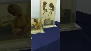 Human Anatomy Expo 2023 at University Malaya - Foetuses Human Anatomy Expo 2023 at University Malaya - Foetuses