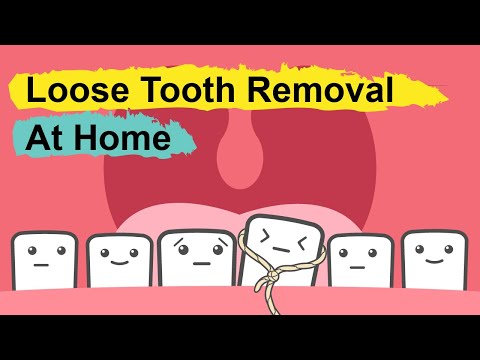 Video: 12 måter å trekke en løs tann hjemme