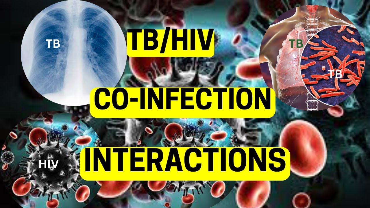 TB & HIV CO-INFECTION INTERACTIONS - YouTube