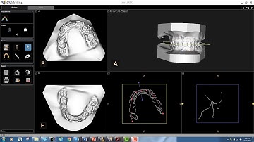 CS Model - Registration of Orthodontic Models CS 3600