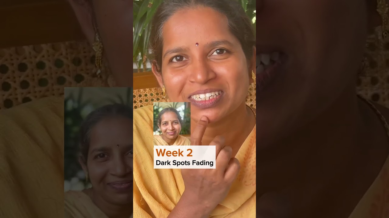 Milk Drops Review | 4 weeks Challenge | Brightening Serum | Skincare | Vilvah serum | Before after