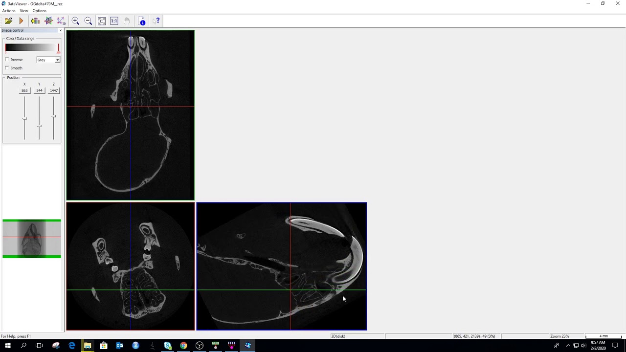 skyscan microCT analysis 2/3, alignment of data orientation and ...