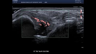 Excerpt From The Msk Imaging Fundamentals - Ankle And Foot