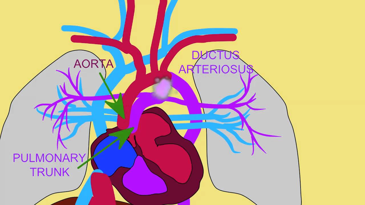 Fetal Ductus Arteriosus