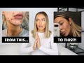 HOW I CLEARED MY ACNE | PRODUCTS THAT ACTUALLY WORK | ALEXXCOLL