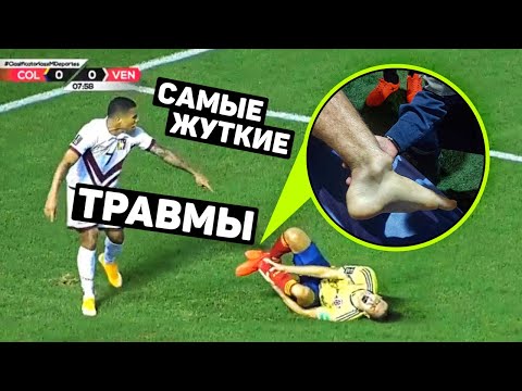ЖУТКИЕ ТРАВМЫ ФУТБОЛИСТОВ 2020. Футбольный топ @user-ov9ve4hg8p
