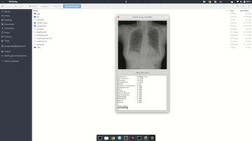 Identifying Medical Conditions from X-rays using Deep Learning
