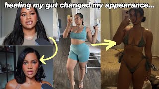 How HEALING MY GUT changed my life | IBS, painful bloating, hormonal issues, etc..