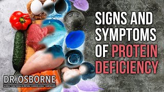 Signs and Symptoms of Protein Deficiency